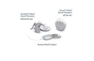 ലോകത്തിലെ ആദ്യത്തെ സ്മാര്ട്ട് കോക്ലിയര് ഇംപ്ലാന്റ് സിസ്റ്റമായ കോക്ലിയര് ന്യൂക്ലിയസ് നെക്സ സിസ്റ്റം പുറത്തിറക്കി